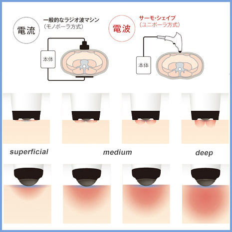 ShouSALON Thermo shape Facial treatment